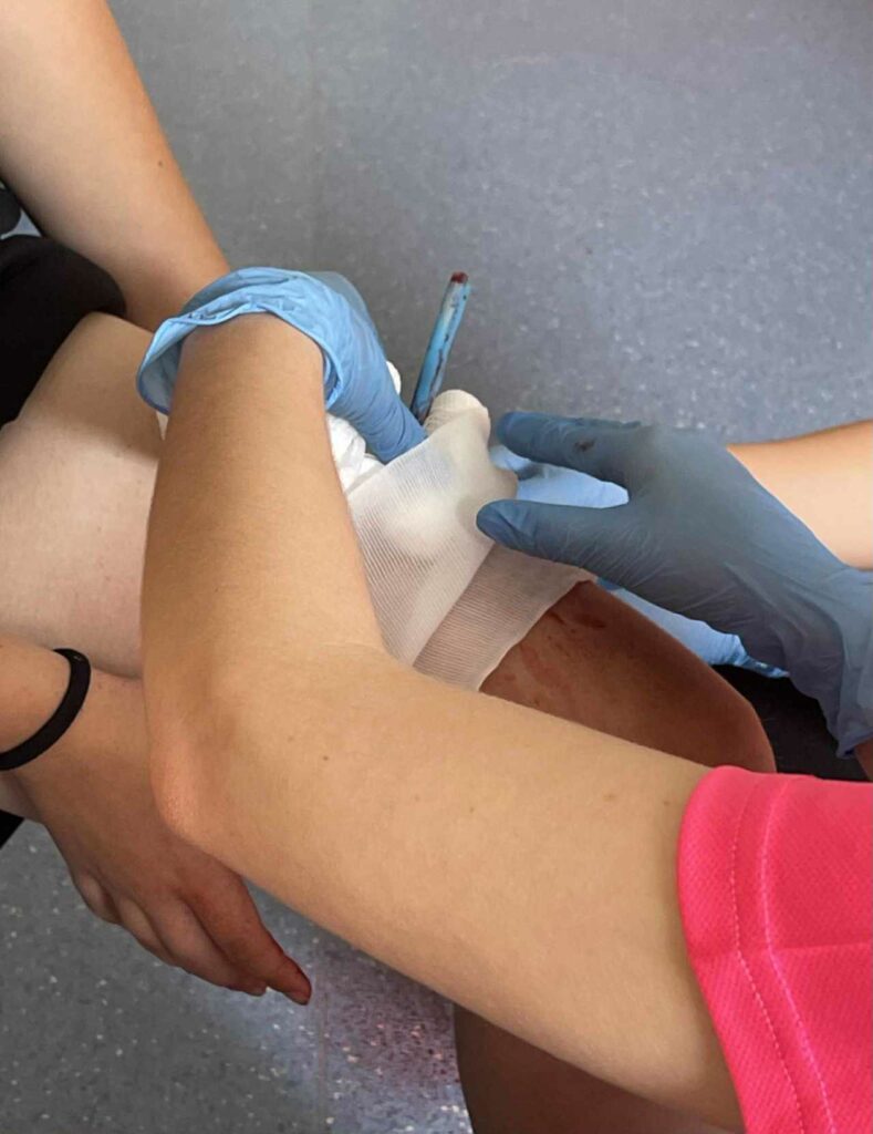 Zdjęcie przedstawia opatrywanie rany na nodze